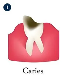 General Dentistry in Hyderabad