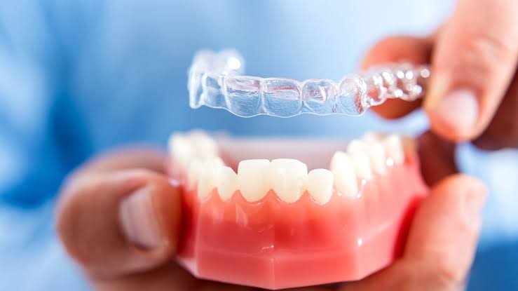 Are clear aligners really invisible for teeth straightening