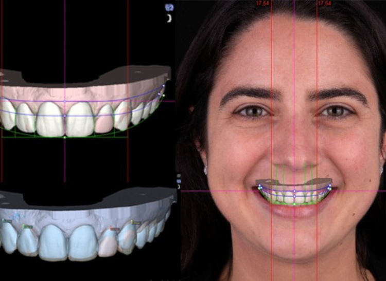 From facial analysis to a perfect smile
Digital Smile Design technology helps dentists identify facial proportions and tooth alignment to design confident, natural-looking smiles with precision